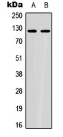 ACLY / ATP Citrate Lyase Antibody - Western blot analysis of ACLY expression in Jurkat (A); HeLa (B) whole cell lysates.
