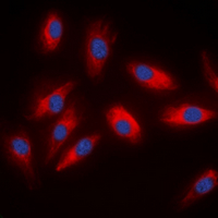 ACLY / ATP Citrate Lyase Antibody - Immunofluorescent analysis of ACLY staining in HeLa cells. Formalin-fixed cells were permeabilized with 0.1% Triton X-100 in TBS for 5-10 minutes and blocked with 3% BSA-PBS for 30 minutes at room temperature. Cells were probed with the primary antibody in 3% BSA-PBS and incubated overnight at 4 ??C in a humidified chamber. Cells were washed with PBST and incubated with a DyLight 594-conjugated secondary antibody (red) in PBS at room temperature in the dark. DAPI was used to stain the cell nuclei (blue).