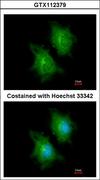 ACLY / ATP Citrate Lyase Antibody - Immunofluorescence of methanol-fixed HeLa, using ATP citrate lyase antibody at 1:200 dilution.