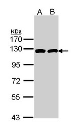 ACLY / ATP Citrate Lyase Antibody - Sample (30 ug of whole cell lysate). A: Hela. B: Raji. 7.5% SDS PAGE. ACLY antibody diluted at 1:1000. 