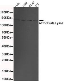 ACLY / ATP Citrate Lyase Antibody - Western blot detection of ATP-Citrate Lyase in 3T3, K562, COS7 and HeLa cell lysates using ATP-Citrate Lyase mouse monoclonal antibody (1:1000 dilution). Predicted band size: 120KDa. Observed band size: 120KDa.