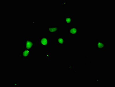 ACLY / ATP Citrate Lyase Antibody - Immunofluorescent analysis of HepG2 cells using ACLY Antibody at dilution of 1:100 and Alexa Fluor 488-congugated AffiniPure Goat Anti-Rabbit IgG(H+L)