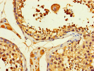 ACLY / ATP Citrate Lyase Antibody - Immunohistochemistry of paraffin-embedded human testis tissue using ACLY Antibody at dilution of 1:100