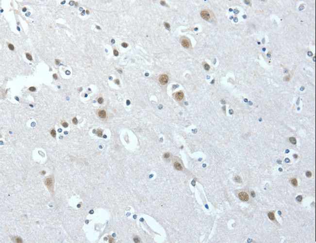 ACLY / ATP Citrate Lyase Antibody - Immunohistochemistry of paraffin-embedded Human brain using ACLY Polyclonal Antibody at dilution of 1:40.