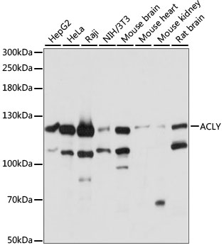 ACLY / ATP Citrate Lyase Antibody - Western blot analysis of extracts of various cell lines, using ACLY antibody at 1:1000 dilution. The secondary antibody used was an HRP Goat Anti-Rabbit IgG (H+L) at 1:10000 dilution. Lysates were loaded 25ug per lane and 3% nonfat dry milk in TBST was used for blocking. An ECL Kit was used for detection and the exposure time was 1s.