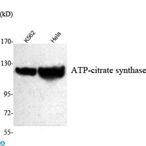 ACLY / ATP Citrate Lyase Antibody - Western Blot (WB) analysis using ATP-citrate synthase Monoclonal Antibody against K562, HeLa cell lysate.