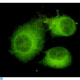ACLY / ATP Citrate Lyase Antibody - Immunofluorescence (IF) analysis of HeLa cells using ATP-citrate synthase Monoclonal Antibody.