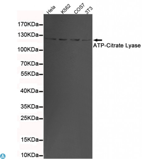 ACLY / ATP Citrate Lyase Antibody - Western blot detection of ATP-Citrate Lyase in 3T3, K562, COS7 and Hela cell lysates using ATP-Citrate Lyase mouse mAb (1:1000 diluted). Predicted band size: 120KDa. Observed band size: 120KDa.