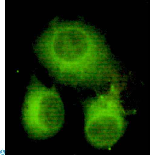 ACLY / ATP Citrate Lyase Antibody - Immunocytochemistry of HeLa cells using anti-ATP-Citrate Lyase (C-term) mouse mAb diluted 1:150.