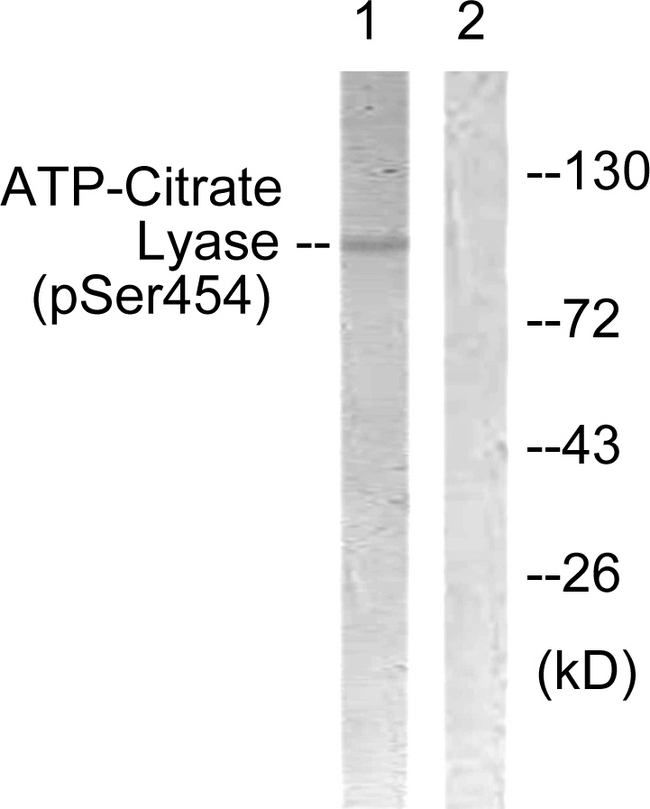 ACLY / ATP Citrate Lyase Antibody - Western blot analysis of lysates from COS7 cells treated with Calyculin 50nM 30', using ATP-Citrate Lyase (Phospho-Ser454) Antibody. The lane on the right is blocked with the phospho peptide.