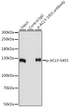 ACLY / ATP Citrate Lyase Antibody - Immunoprecipitation analysis of 200ug extracts of NIH/3T3 cells, using 3 ug Phospho-ACLY-S455 pAb. Western blot was performed from the immunoprecipitate using Phospho-ACLY-S455 pAb at a dilition of 1:1000. NIH/3T3 cells were treated by Insulin (100 nM) at 37°C for 10 minutes after serum-starvation overnight.