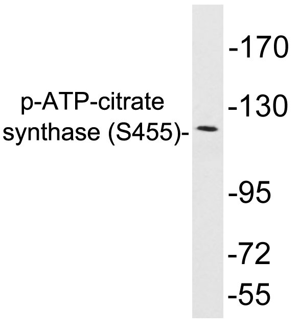 ACLY / ATP Citrate Lyase Antibody - Western blot analysis of lysates from COS7 cells treated with Calyculin, using phospho-ATP-citrate synthase (Phospho-Ser455) antibody.
