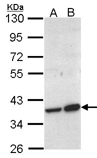 ACMSD Antibody - Sample (30 ug of whole cell lysate). A: Molt-4 , B: Raji. 10% SDS PAGE. ACMSD antibody diluted at 1:1000.