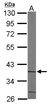 ACMSD Antibody - Sample (50 ug of whole cell lysate). A: Mouse brain. 10% SDS PAGE. ACMSD antibody diluted at 1:1000.
