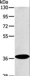 ACMSD Antibody - Western blot analysis of Raji cell, using ACMSD Polyclonal Antibody at dilution of 1:400.