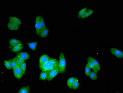 ACMSD Antibody - Immunofluorescent analysis of HepG2 cells at a dilution of 1:100 and Alexa Fluor 488-congugated AffiniPure Goat Anti-Rabbit IgG(H+L)