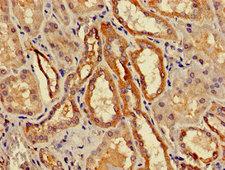 ACMSD Antibody - Immunohistochemistry image of paraffin-embedded human kidney tissue at a dilution of 1:100