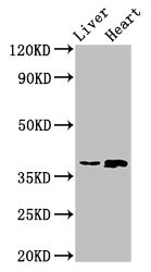 ACMSD Antibody - Positive Western Blot detected in Rat liver tissue, Rat heart tissue. All lanes: ACMSD antibody at 4 µg/ml Secondary Goat polyclonal to rabbit IgG at 1/50000 dilution. Predicted band size: 39, 32 KDa. Observed band size: 39 KDa