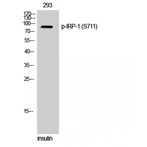 ACO1 / Aconitase Antibody - Western blot of Phospho-IRP-1 (S711) antibody