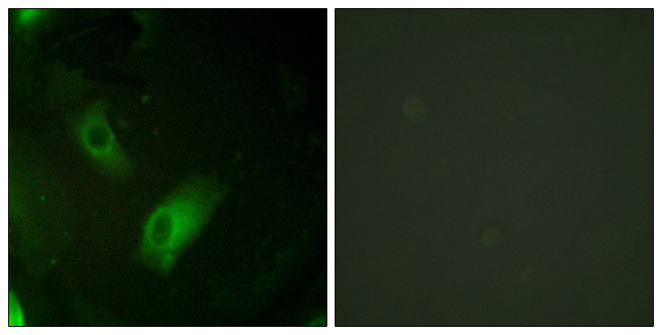 ACO1 / Aconitase Antibody - Immunofluorescence analysis of HeLa cells, using IREB1 Antibody. The picture on the right is blocked with the synthesized peptide.