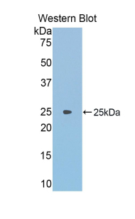 ACO1 / Aconitase Antibody - Western blot of recombinant IRP1 / Aconitase.  This image was taken for the unconjugated form of this product. Other forms have not been tested.