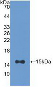 ACO1 / Aconitase Antibody - Western Blot; Sample: Recombinant ACO1, Human.