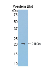 ACO1 / Aconitase Antibody - Western blot of recombinant IRP1 / Aconitase.  This image was taken for the unconjugated form of this product. Other forms have not been tested.