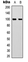 ACO1 / Aconitase Antibody - Western blot analysis of Aconitase 1 (pS711) expression in HeLa (A); HUVEC (B) whole cell lysates.
