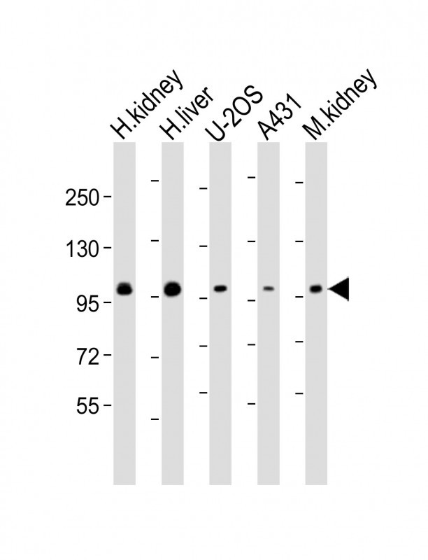 ACO1 / Aconitase Antibody - All lanes: Anti-ACO1 Antibody (Center) at 1:2000 dilution Lane 1: human kidney lysate Lane 2: human liver lysate Lane 3: U-2OS whole cell lysate Lane 4: A431 whole cell lysate Lane 5: mouse kidney lysate Lysates/proteins at 20 µg per lane. Secondary Goat Anti-Rabbit IgG, (H+L), Peroxidase conjugated at 1/10000 dilution. Predicted band size: 98 kDa Blocking/Dilution buffer: 5% NFDM/TBST.