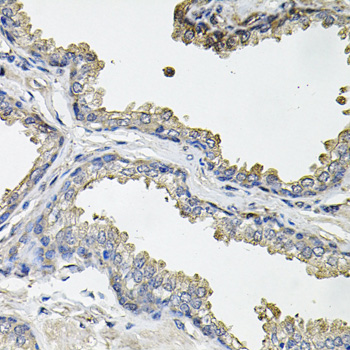 ACO1 / Aconitase Antibody - Immunohistochemistry of paraffin-embedded human prostate.