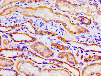 ACO1 / Aconitase Antibody - Immunohistochemistry image of paraffin-embedded human kidney tissue at a dilution of 1:100