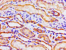 ACO1 / Aconitase Antibody - Immunohistochemistry image of paraffin-embedded human kidney tissue at a dilution of 1:100