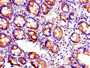ACO1 / Aconitase Antibody - Immunohistochemistry image of paraffin-embedded human small intestine tissue at a dilution of 1:100