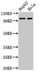 ACO1 / Aconitase Antibody - Positive Western Blot detected in HepG2 whole cell lysate, Hela whole cell lysate. All lanes: ACO1 antibody at 3 µg/ml Secondary Goat polyclonal to rabbit IgG at 1/50000 dilution. Predicted band size: 99 KDa. Observed band size: 99 KDa