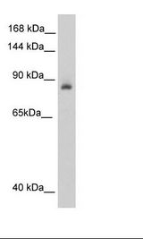 ACO1 / Aconitase Antibody - Fetal Kidney Lysate.  This image was taken for the unconjugated form of this product. Other forms have not been tested.