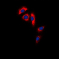 ACO1 / Aconitase Antibody - Immunofluorescent analysis of Aconitase 1 staining in HeLa cells. Formalin-fixed cells were permeabilized with 0.1% Triton X-100 in TBS for 5-10 minutes and blocked with 3% BSA-PBS for 30 minutes at room temperature. Cells were probed with the primary antibody in 3% BSA-PBS and incubated overnight at 4 deg C in a humidified chamber. Cells were washed with PBST and incubated with a DyLight 594-conjugated secondary antibody (red) in PBS at room temperature in the dark. DAPI was used to stain the cell nuclei (blue).