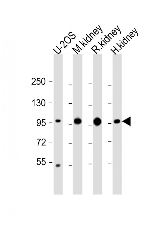 ACO1 / Aconitase Antibody - All lanes: Anti-ACO1 Antibody (N-Term) at 1:2000 dilution Lane 1: U-2OS whole cell lysate Lane 2: mouse kidney lysate Lane 3: rat kidney lysate Lane 4: human kidney lysate Lysates/proteins at 20 µg per lane. Secondary Goat Anti-Rabbit IgG, (H+L), Peroxidase conjugated at 1/10000 dilution. Predicted band size: 98 kDa Blocking/Dilution buffer: 5% NFDM/TBST.