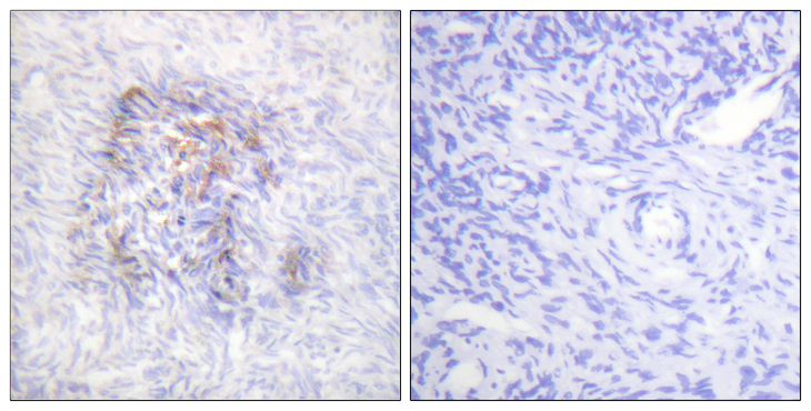 ACO1 / Aconitase Antibody - Immunohistochemistry analysis of paraffin-embedded human ovary, using IREB1 (Phospho-Ser138) Antibody. The picture on the right is blocked with the phospho peptide.