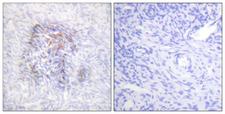 ACO1 / Aconitase Antibody - Immunohistochemistry analysis of paraffin-embedded human ovary, using IREB1 (Phospho-Ser138) Antibody. The picture on the right is blocked with the phospho peptide.