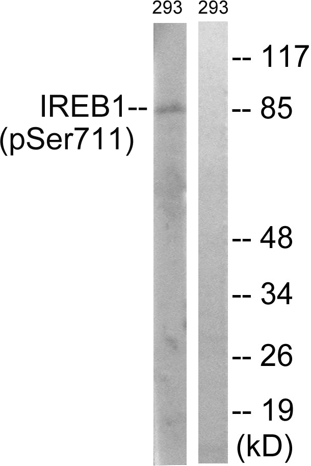 ACO1 / Aconitase Antibody - Western blot analysis of lysates from 293 cells treated with insulin 0.01U/ml 30', using IREB1 (Phospho-Ser711) Antibody. The lane on the right is blocked with the phospho peptide.