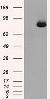 ACO2 / Aconitase 2 Antibody - HEK293T cells were transfected with the pCMV6-ENTRY control (Left lane) or pCMV6-ENTRY ACO2 (Right lane) cDNA for 48 hrs and lysed. Equivalent amounts of cell lysates (5 ug per lane) were separated by SDS-PAGE and immunoblotted with anti-ACO2.