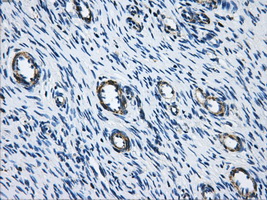 ACO2 / Aconitase 2 Antibody - IHC of paraffin-embedded Ovary tissue using anti-ACO2 mouse monoclonal antibody. (Dilution 1:50).