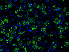 ACO2 / Aconitase 2 Antibody - Anti-ACO2 mouse monoclonal antibody  immunofluorescent staining of COS7 cells transiently transfected by pCMV6-ENTRY ACO2.