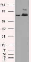 ACO2 / Aconitase 2 Antibody - HEK293T cells were transfected with the pCMV6-ENTRY control (Left lane) or pCMV6-ENTRY ACO2 (Right lane) cDNA for 48 hrs and lysed. Equivalent amounts of cell lysates (5 ug per lane) were separated by SDS-PAGE and immunoblotted with anti-ACO2.