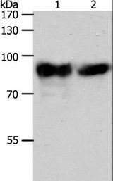 ACO2 / Aconitase 2 Antibody - Western blot analysis of Mouse heart tissue and HeLa cell, using ACO2 Polyclonal Antibody at dilution of 1:400.