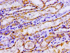 ACO2 / Aconitase 2 Antibody - Immunohistochemistry image of paraffin-embedded human kidney tissue at a dilution of 1:100