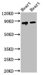 ACO2 / Aconitase 2 Antibody - Positive Western Blot detected in Rat heart tissue, Mouse heart tissue. All lanes: ACO2 antibody at 2.5 µg/ml Secondary Goat polyclonal to rabbit IgG at 1/50000 dilution. Predicted band size: 86 KDa. Observed band size: 86 KDa