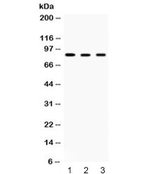 ACO2 / Aconitase 2 Antibody - Western blot testing of 1) rat skeletal muscle, 2) mouse brain and 3) human HeLa lysate with Aconitase 2 antibody at 0.1ug/ml. Predicted/observed molecular weight: ~85 kDa.