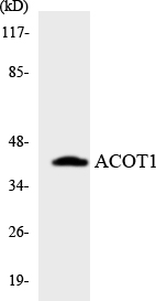 ACOT1 Antibody - Western blot analysis of the lysates from HT-29 cells using ACOT1 antibody.