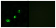 ACOT1 Antibody - Immunofluorescence analysis of MCF7 cells, using ACOT1 Antibody. The picture on the right is blocked with the synthesized peptide.